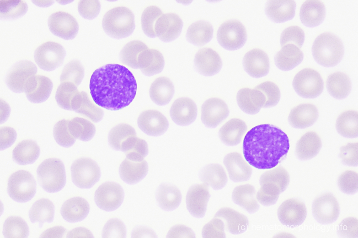 Blasts Hematomorphology, a databank / imagebank for hematology, blood