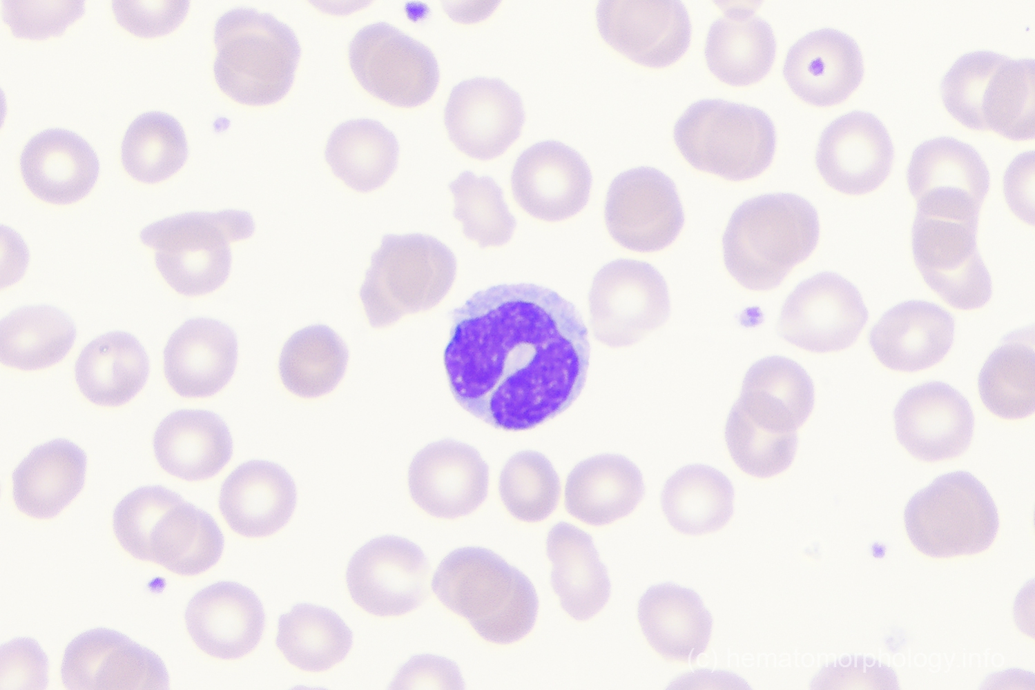 Monocytes - Hematomorphology, a databank / imagebank for hematology