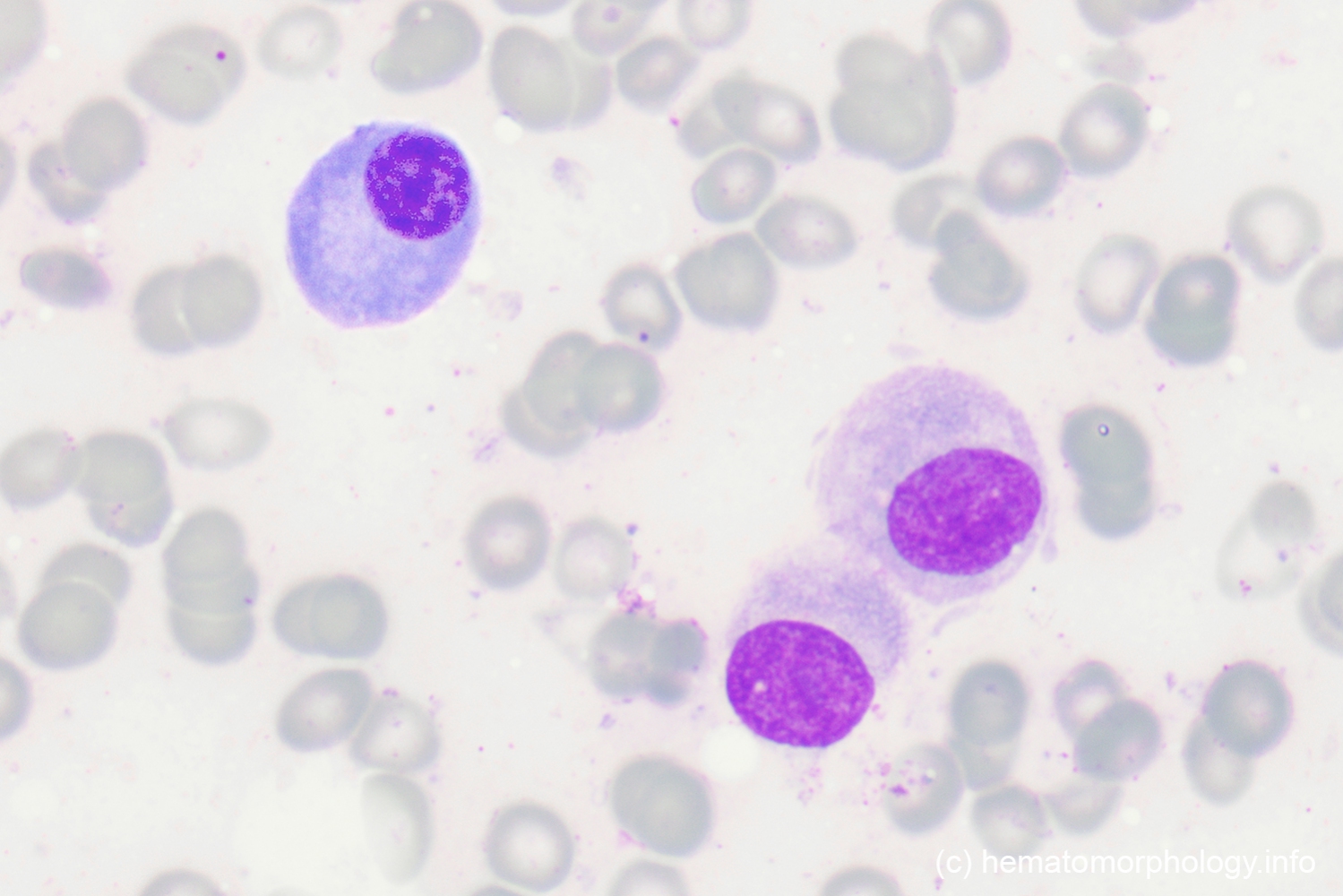 Osteoclasts / Osteoblasts - Hematomorphology, a databank / imagebank