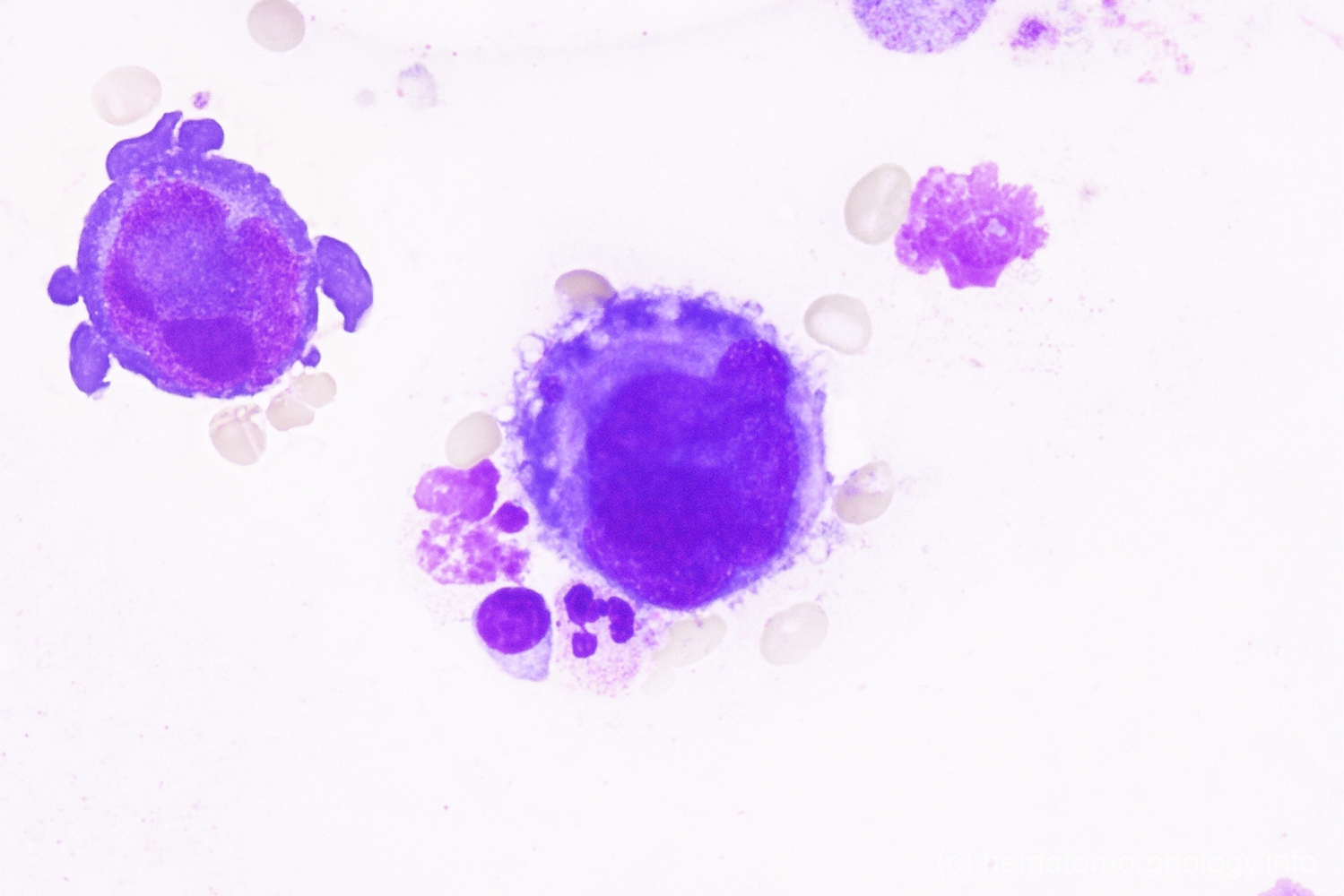 Parvo infection - Hematomorphology, a databank / imagebank for ...