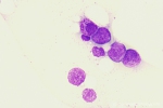 AML-M3-BM-04