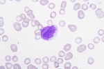 AML-M3-PB-43