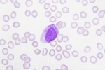 AML-M3-PB-44