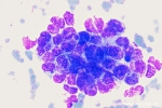 mammacarcinoom-bm-33