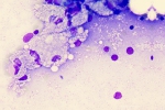 mycobacterium-bm-01