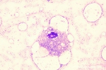 mycobacterium-bm-13