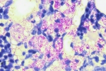 mycobacterium-bm-22