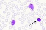 EBV-pb-19-denoise-denoise